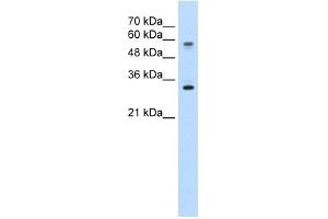 SLC22A1 antibody used at 5 ug/ml to detect target protein. (SLC22A1 抗体)