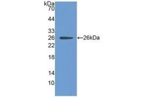 Detection of Recombinant CLIC1, Human using Polyclonal Antibody to Chloride Intracellular Channel Protein 1 (CLIC1) (CLIC1 抗体  (AA 79-241))