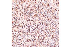 Immunohistochemistry of paraffin-embedded human tonsil using  antibody (ABIN3023072, ABIN3023073, ABIN3023074 and ABIN6219376) at dilution of 1:100 (40x lens). (ALOX5 抗体  (AA 1-300))
