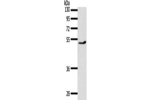 Gel: 10 % SDS-PAGE, Lysate: 40 μg, Lane: Mouse heart tissue, Primary antibody: ABIN7191971(PPARD Antibody) at dilution 1/500, Secondary antibody: Goat anti rabbit IgG at 1/8000 dilution, Exposure time: 30 seconds (PPARD 抗体)