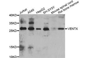 Western blot analysis of extracts of various cell lines, using VENTX antibody. (VENTX 抗体)
