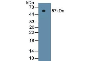 Detection of Recombinant ITGb1, Human using Monoclonal Antibody to Integrin Beta 1 (ITGb1) (ITGB1 抗体  (AA 140-383))