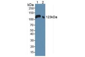 Western blot analysis of (1) Mouse Serum and (2) Mouse Placenta Tissue. (LIFR 抗体  (AA 381-485))