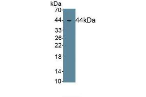 Detection of Recombinant EAAT2, Human using Polyclonal Antibody to Excitatory Amino Acid Transporter 2 (EAAT2) (SLC1A2 抗体  (AA 1-44))