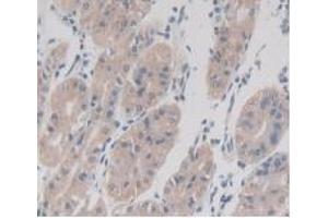 Detection of TMEM27 in Human Stomach Tissue using Monoclonal Antibody to Transmembrane Protein 27 (TMEM27) (TMEM27 抗体  (AA 17-137))