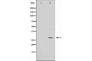 Western blot analysis on Jurkat cell lysate using GADD153 Antibody,The lane on the left is treated with the antigen-specific peptide. (DDIT3 抗体  (N-Term))