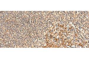 Immunohistochemistry of paraffin-embedded Human tonsil tissue using GALNT12 Polyclonal Antibody at dilution of 1:60(x200) (GALNT12 抗体)