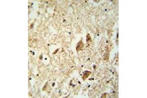 Immunohistochemistry analysis in formalin fixed and paraffin embedded human brain tissue reacted with KATNAL1 Antibody (N-term) followed which was peroxidase conjugated to the secondary antibody and followed by DAB staining. (KATNAL1 抗体  (N-Term))