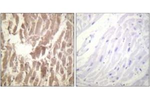 Immunohistochemistry analysis of paraffin-embedded human heart, using TNNI3 (Phospho-Ser43) Antibody. (TNNI3 抗体  (pSer43))