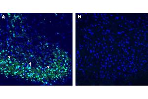 Expression of C3aR1 in rat spinal cord. (C3AR1 抗体  (Extracellular))