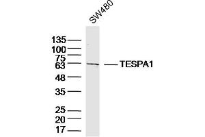 SW480 lysates probed with TESPA1 Polyclonal Antibody, Unconjugated  at 1:300 dilution and 4˚C overnight incubation. (TESPA1 抗体  (AA 231-330))