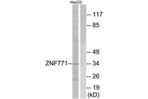 Western blot analysis of extracts from HepG2 cells, using ZNF771 Antibody. (ZNF771 抗体  (AA 161-210))