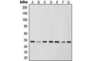 Western blot analysis of IKK gamma expression in Jurkat (A), HL60 (B), HeLa (C), NIH3T3 (D), Raw264. (IKBKG 抗体  (Center))