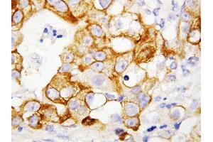 Immunohistochemistry (IHC) image for anti-Tumor Necrosis Factor Receptor Superfamily, Member 1B (TNFRSF1B) (AA 103-121), (Middle Region) antibody (ABIN3044354)
