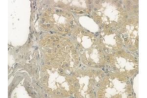 ABIN6257237 and ABIN6273355 at 1/100 staining human normal kidney tissue by IHC-P.