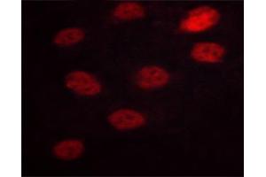 ABIN6267629 staining HeLa cells by ICC/IF. (NFATC3 抗体  (pSer165))