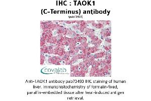 Image no. 2 for anti-TAO Kinase 1 (TAOK1) (C-Term) antibody (ABIN1739898) (TAO Kinase 1 (TAOK1) (C-Term) 抗体)