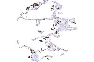 Normal lung showing strong Napsin A immunostaining of pneumocytes and alveolar macrophages (Recombinant NAPSA 抗体  (AA 189-299))