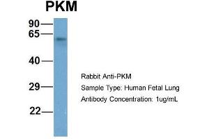 Host: Rabbit  Target Name: PKM  Sample Tissue: Human Fetal Lung  Antibody Dilution: 1. (PKM2 抗体  (Middle Region))