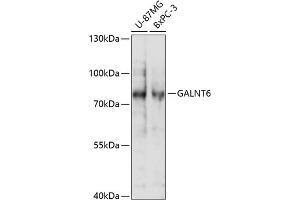 Western blot analysis of extracts of various cell lines, using G antibody (ABIN7271209) at 1:1000 dilution. (GALNT6 抗体  (AA 30-140))