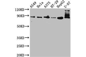 Western Blot Positive WB detected in: A549 whole cell lysate, Hela whole cell lysate, A375 whole cell lysate, HT-29 whole cell lysate, HepG2 whole cell lysate, U-87 whole cell lysate All lanes: Furin antibody at 1:1000 Secondary Goat polyclonal to rabbit IgG at 1/50000 dilution Predicted band size: 87 kDa Observed band size: 87, 72 kDa (Recombinant FURIN 抗体)