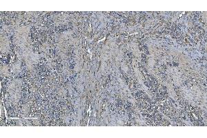 IHC analysis of PNPT1 using anti-PNPT1 antibody (ABIN7599172).