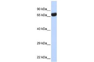 TPTE antibody used at 1 ug/ml to detect target protein. (TPTE 抗体  (Middle Region))