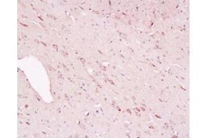 Formalin-fixed and paraffin embedded rat brain labeled with Rabbit Anti-Tyrosine Hydroxylase(Neuronal Marker)/Tyk2/TYH Polyclonal Antibody, Unconjugated  1:200 followed by conjugation to the secondary antibody and DAB staining (Tyrosine Hydroxylase 抗体  (AA 101-165))