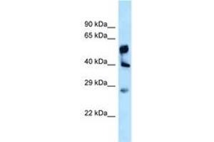 Image no. 1 for anti-Lysophosphatidylglycerol Acyltransferase 1 (LPGAT1) (AA 230-279) antibody (ABIN6747957) (LPGAT1 抗体  (AA 230-279))