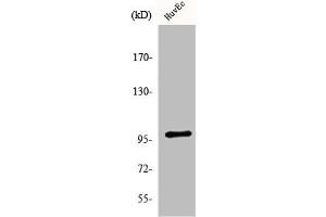 Western Blot analysis of HeLa cells using MRTF-A Polyclonal Antibody (MKL1 抗体  (N-Term))