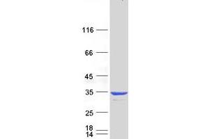 Western Blotting (WB) image for Crystallin, beta B1 (CRYBB1) protein (Myc-DYKDDDDK Tag) (ABIN2715238)