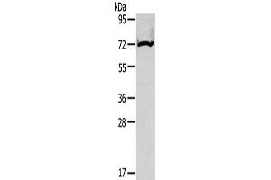 Western Blotting (WB) image for anti-Carnitine Palmitoyltransferase 2 (CPT2) antibody (ABIN2425697) (CPT2 抗体)