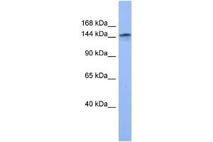 WB Suggested Anti-COL4A3 Antibody Titration: 0. (COL4a3 抗体  (Middle Region))