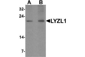 Western blot analysis of LYZL1 in A20 cell lysate with LYZL1 Antibody  at (A) 1 and (B) 2 ug/mL. (Lysozyme-Like 1 抗体  (N-Term))