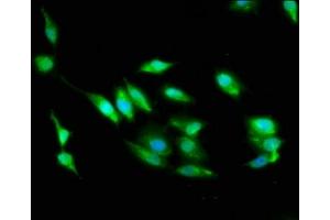 Immunofluorescence staining of Hela cells with ABIN7168982 at 1:100, counter-stained with DAPI. (STK24 抗体  (AA 1-431))