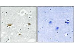 Immunohistochemistry analysis of paraffin-embedded human brain, using STK39 (Phospho-Ser325) Antibody. (STK39 抗体  (pSer325))