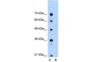 SLA/LP antibody used at 1 ug/ml to detect target protein.