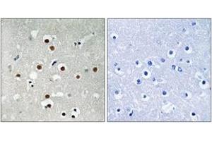 Immunohistochemistry analysis of paraffin-embedded human brain, using MEF2C (Phospho-Ser396) Antibody. (MEF2C 抗体  (pSer396))