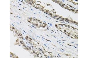 Immunohistochemistry of paraffin-embedded Human prostate using TCEB1 Polyclonal Antibody