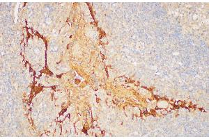Immunohistochemistry of paraffin-embedded Human tonsil using SERPINB2 Polycloanl Antibody at dilution of 1:200 (SERPINB2 抗体)