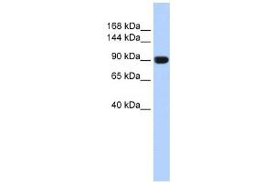 TMEM16A antibody used at 1 ug/ml to detect target protein. (ANO1 抗体  (Middle Region))