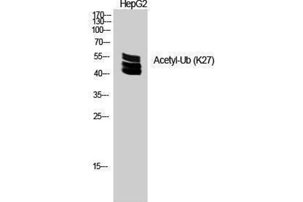Ubiquitin 抗体  (acLys27)