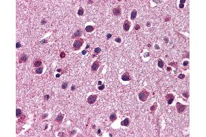 anti-5-Hydroxytryptamine (serotonin) Receptor 3, Family Member C (HTR3C) (AA 360-409) antibody