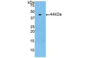 Detection of Recombinant PIP, Mouse using Polyclonal Antibody to Prolactin Induced Protein (PIP) (PIP 抗体  (AA 1-146))