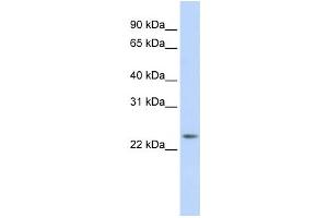 Western Blotting (WB) image for anti-RAB8A, Member RAS Oncogene Family (RAB8A) antibody (ABIN2460114) (RAB8A 抗体)