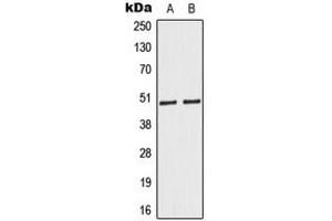 Western blot analysis of Caspase 9 expression in HeLa (A), Jurkat (B) whole cell lysates. (Caspase 9 抗体  (Center))