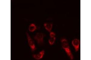 ABIN6269334 staining MCF-7 cells by IF/ICC. (BCL2L1 抗体  (N-Term))