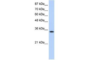 MBNL1 antibody used at 0. (MBNL1 抗体)