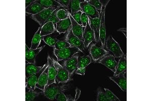 Immunofluorescence (IF) image for anti-Antigen Identified By Monoclonal Antibody Ki-67 (MKI67) (AA 2293-2478) antibody (ABIN6940052)