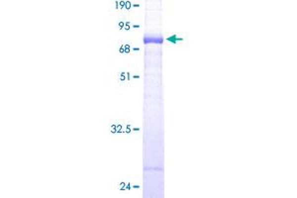 PHKG1 Protein (AA 1-387) (GST tag)